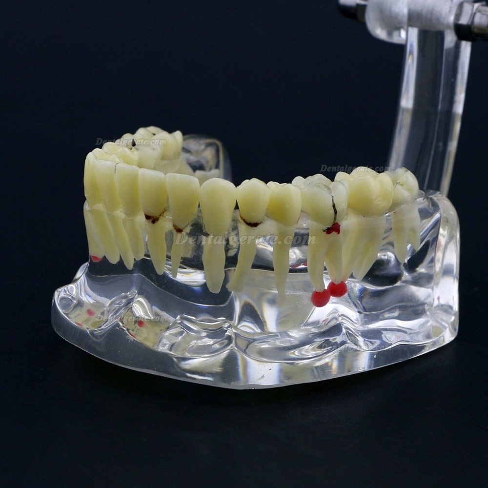 Neue Dental Teach-Studie Allgemeine Erwachsenenpathologie Typodont Z&auml;hne Modell # 4001